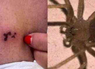 Ragno Violino Morsicatura: Donna Ferita a Gravina in Puglia – Attesa in Ospedale 10 Ore news-25092024-001329