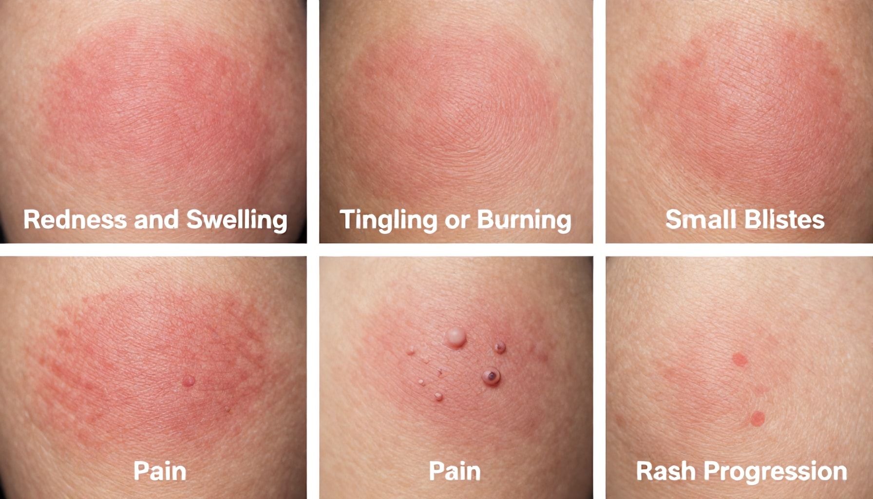 5 modi per identificare le fasi iniziali del fuoco di Sant'Antonio attraverso le immagini*